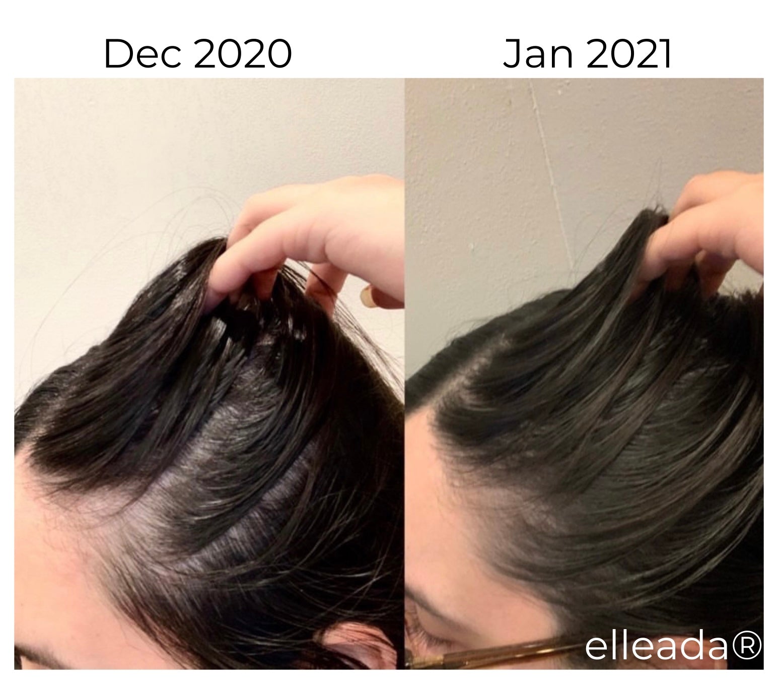 Elleada Natural Hair Growth Serum – Vegan, Oil-Free Scalp Treatment (2oz or 4oz)