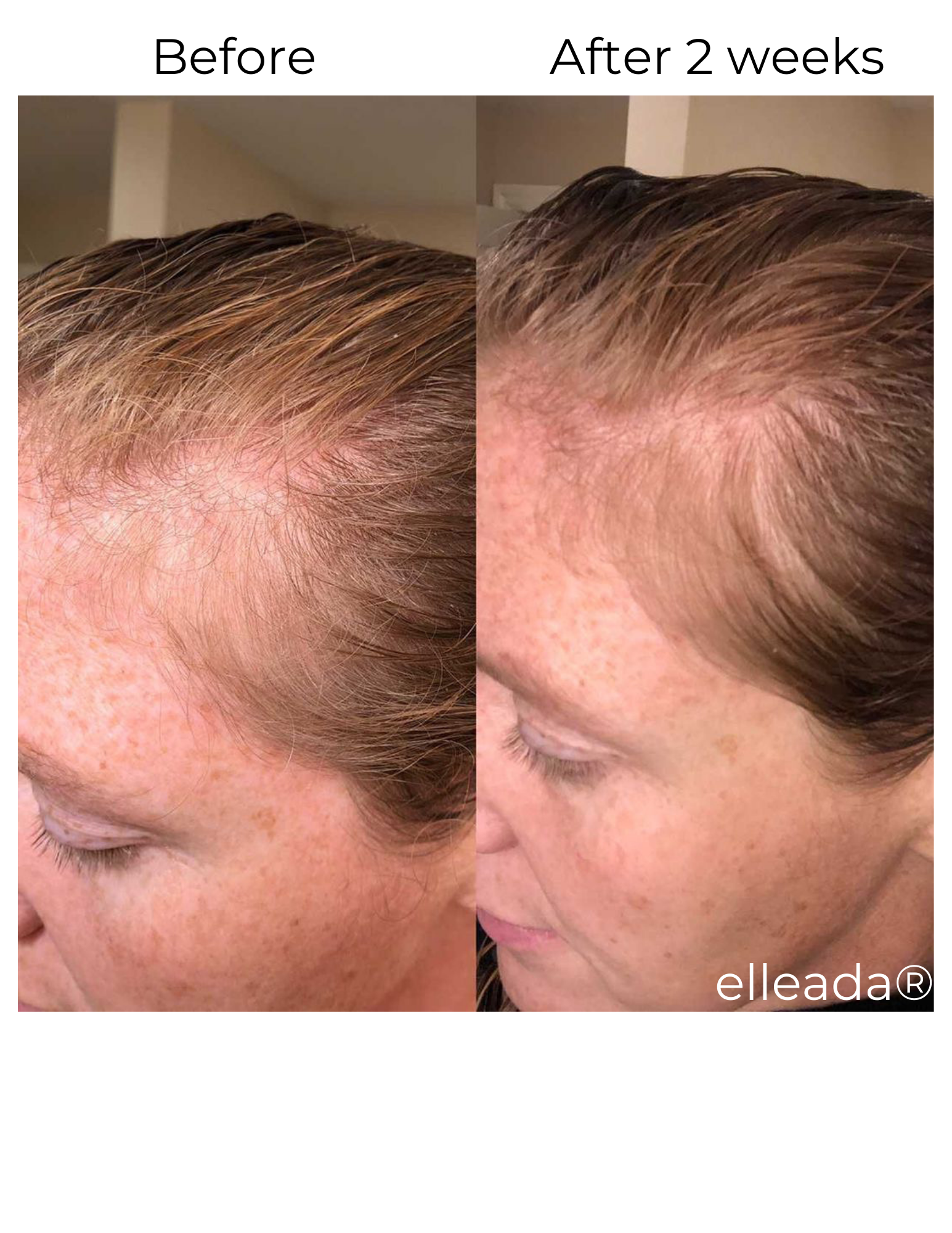Elleada Natural Hair Growth Serum – Vegan, Oil-Free Scalp Treatment (2oz or 4oz)