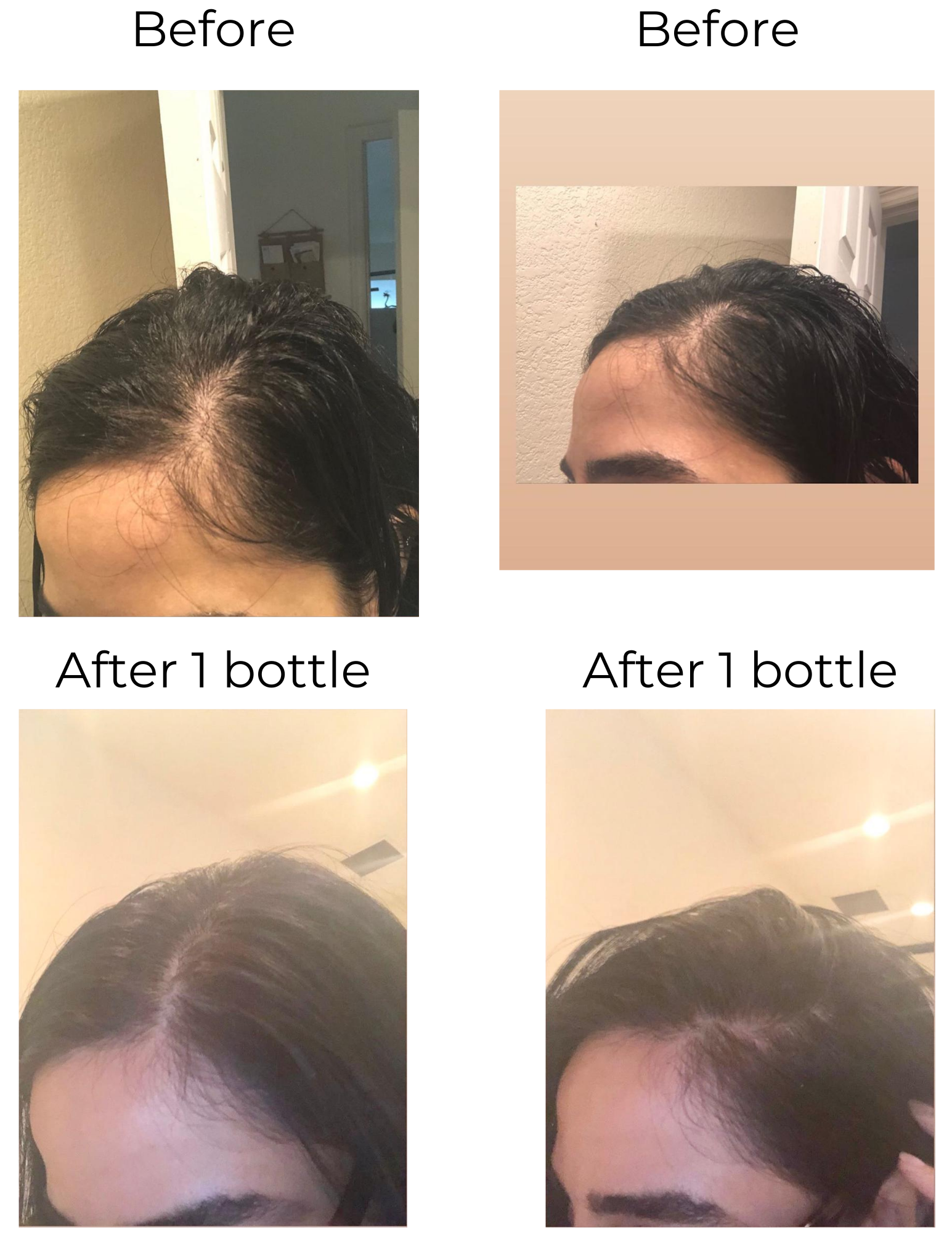 Elleada Natural Hair Growth Serum – Vegan, Oil-Free Scalp Treatment (2oz or 4oz)