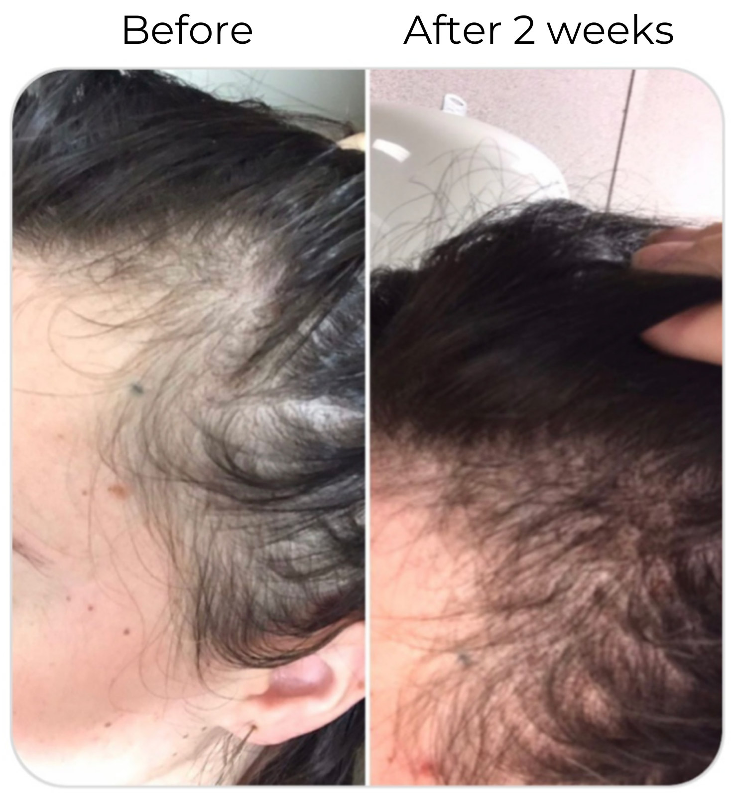 Elleada Natural Hair Growth Serum – Vegan, Oil-Free Scalp Treatment (2oz or 4oz)