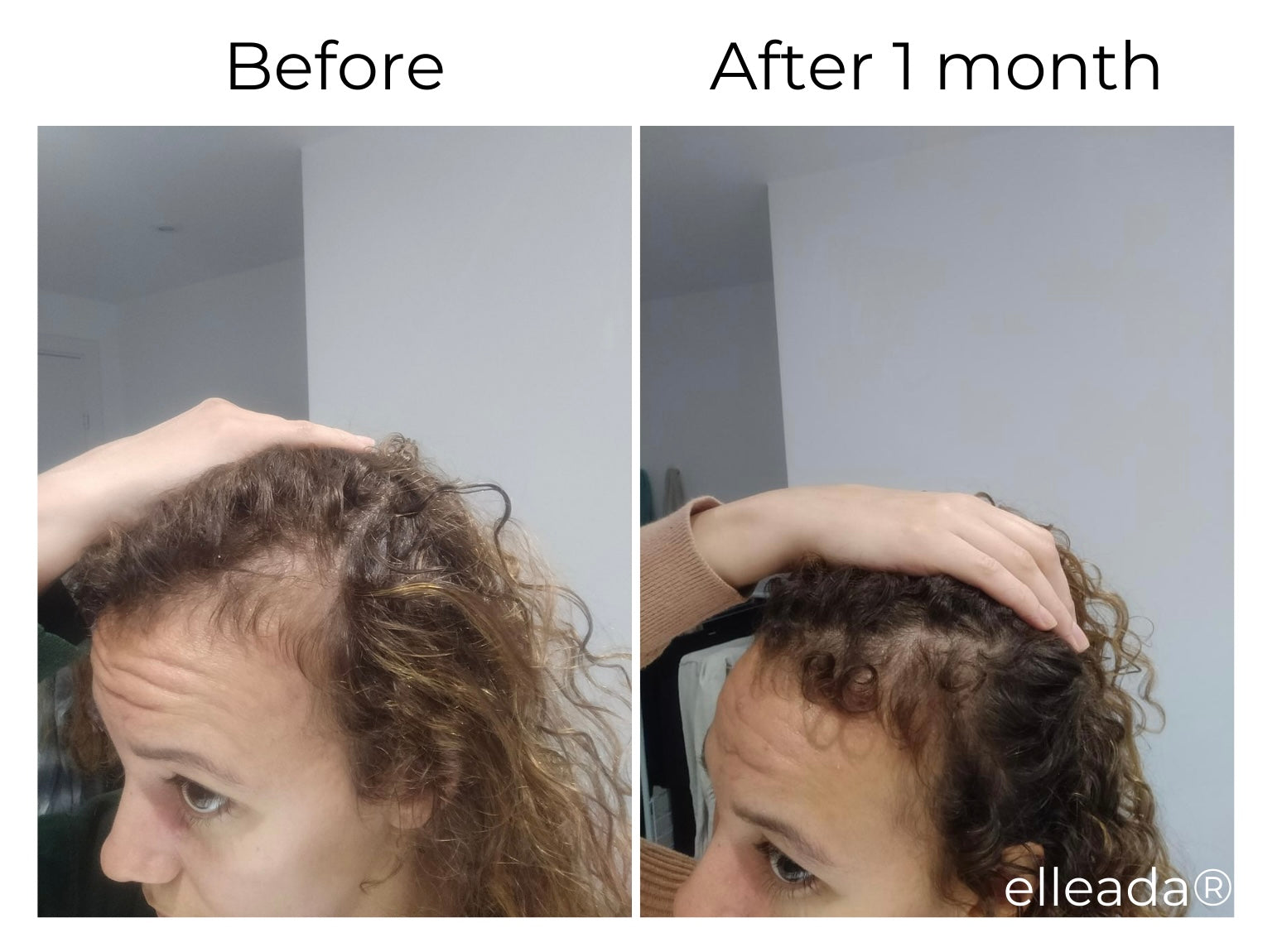 Elleada Natural Hair Growth Serum – Vegan, Oil-Free Scalp Treatment (2oz or 4oz)