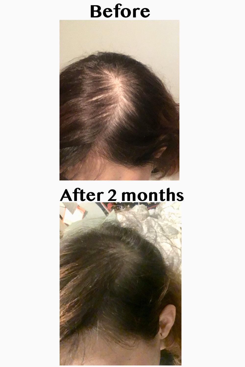 Elleada Natural Hair Growth Serum – Vegan, Oil-Free Scalp Treatment (2oz or 4oz)