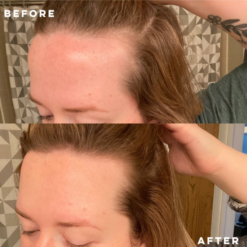 Elleada Natural Hair Growth Serum – Vegan, Oil-Free Scalp Treatment (2oz or 4oz)
