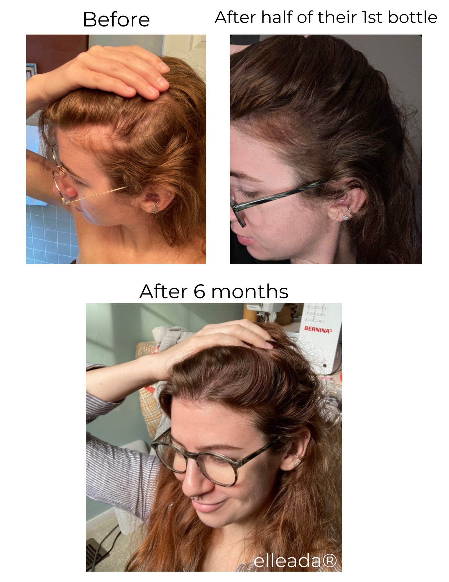 Elleada Natural Hair Growth Serum – Vegan, Oil-Free Scalp Treatment (2oz or 4oz)