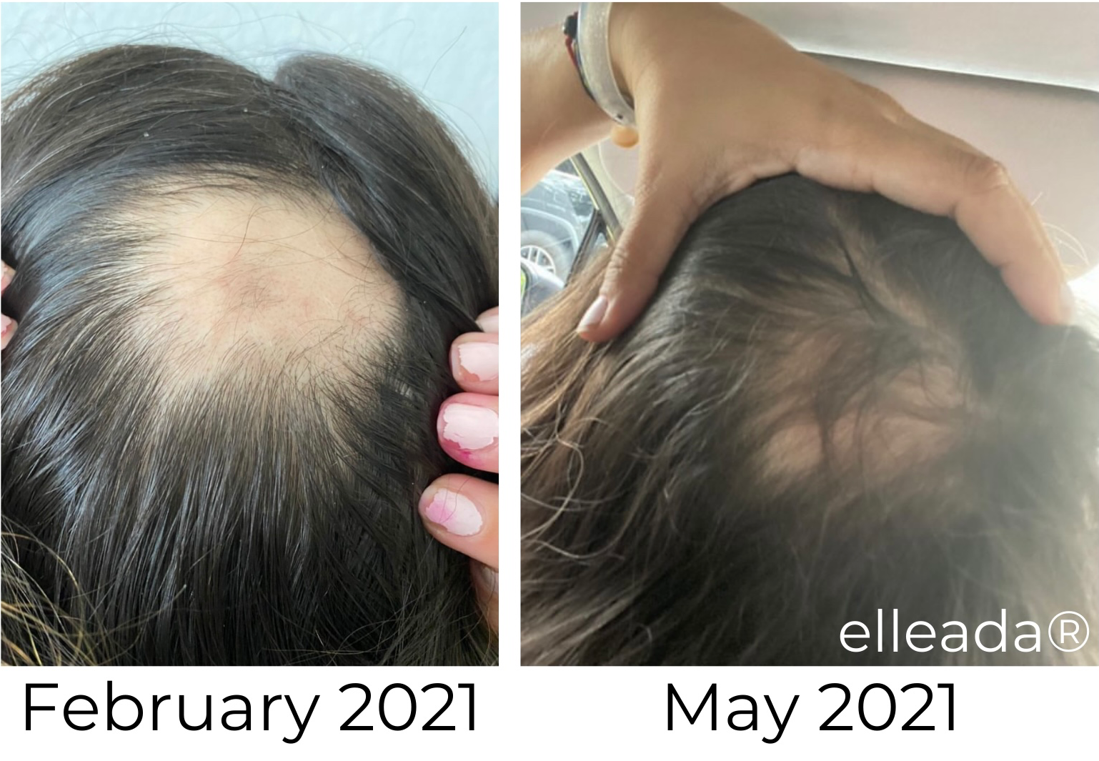Elleada Natural Hair Growth Serum – Vegan, Oil-Free Scalp Treatment (2oz or 4oz)