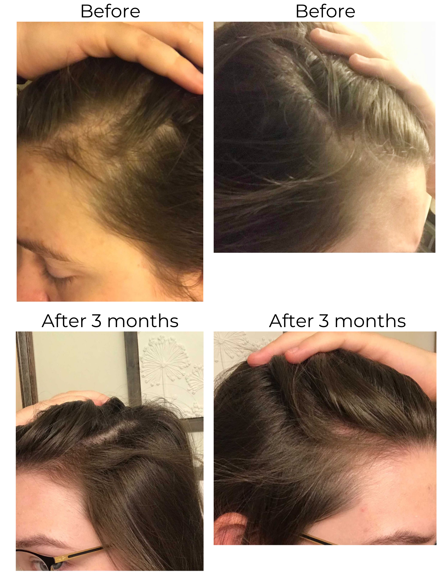 Elleada Natural Hair Growth Serum – Vegan, Oil-Free Scalp Treatment (2oz or 4oz)