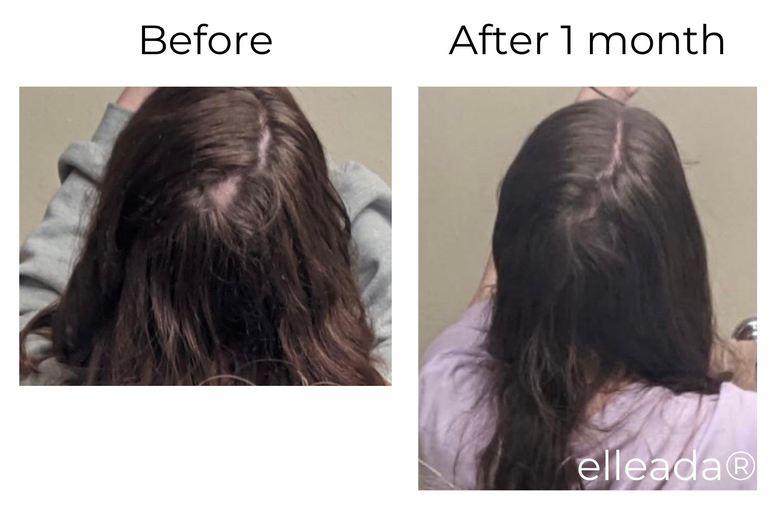 Elleada Natural Hair Growth Serum – Vegan, Oil-Free Scalp Treatment (2oz or 4oz)
